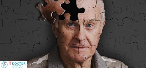 Suy giảm nhận thức là gì? - Bác sĩ giải đáp